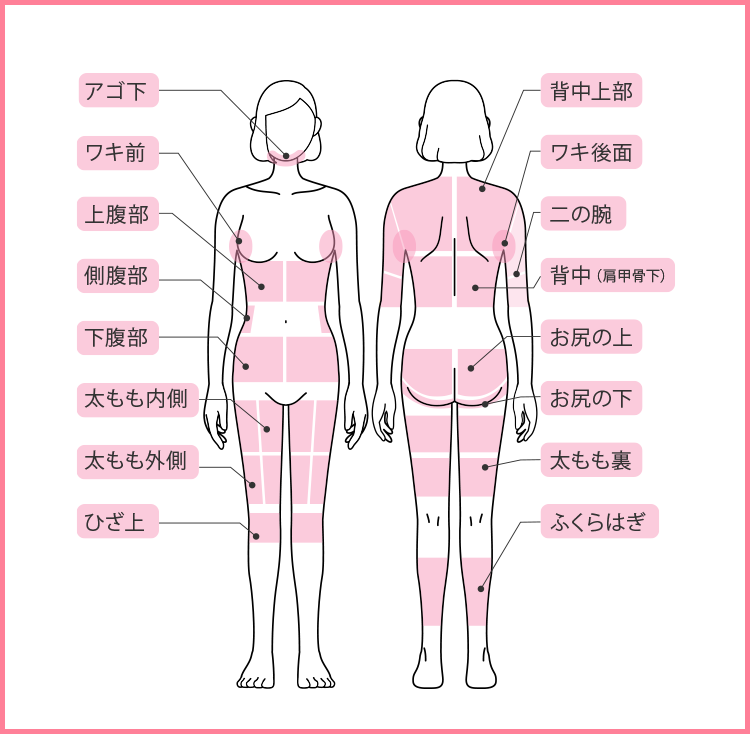 スルリム注射（脂肪破壊術）の施術可能部位