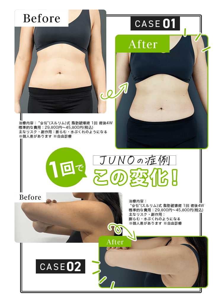 JUNOの症例