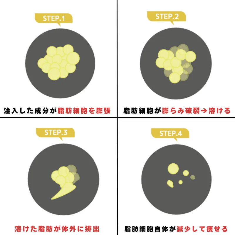脂肪破壊術のSTEP1〜STEP4